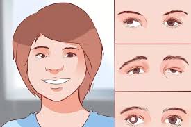 Triệu Chứng Nhược Thị Triệu Chứng Nhược Thị